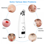 Toyuugo Blackhead Vacuum Remover - Image 2